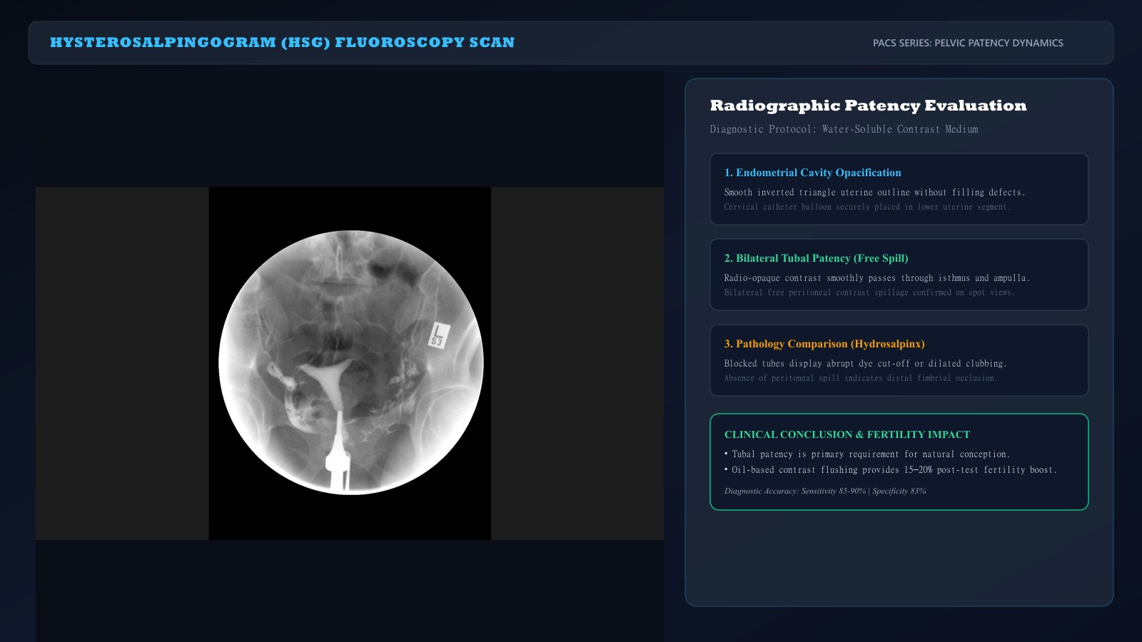 Tubal Patency Diagnostic Protocols: HSG, HyCoSy, and Laparoscopy Diagnostic imaging protocol comparison for tubal factor infertility: HSG fluoroscopy, HyCoSy ultrasound, and laparoscopic chromotubation